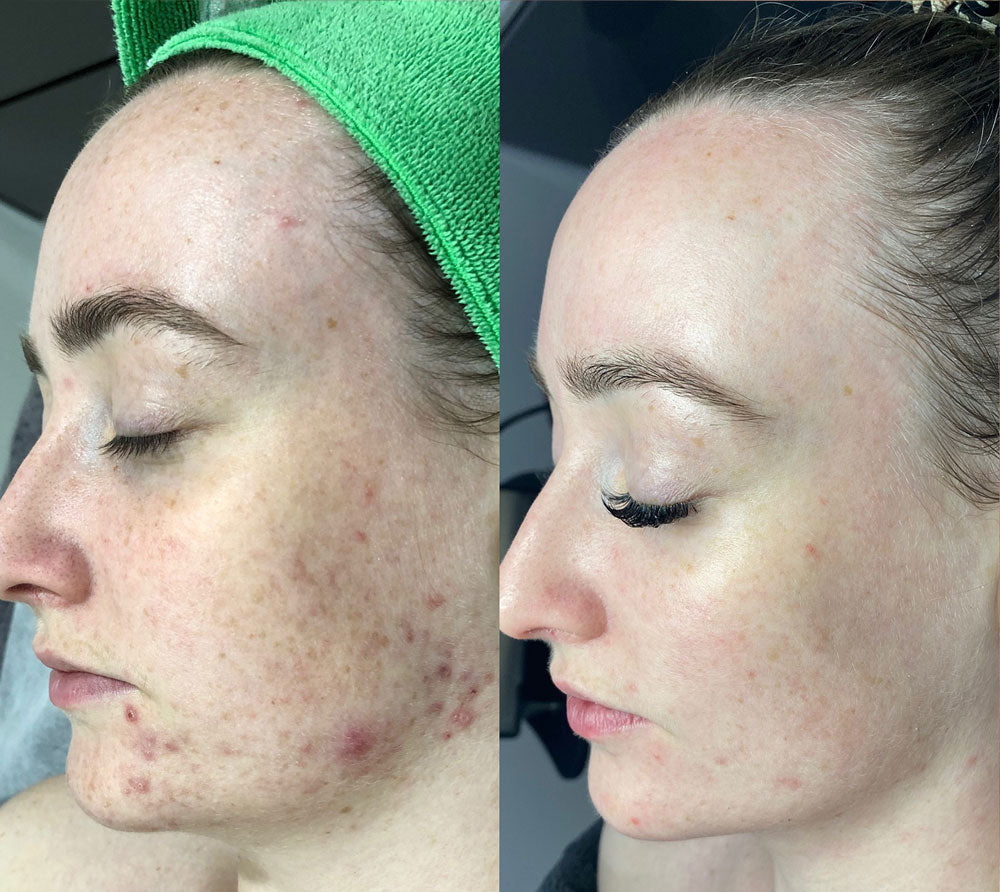 JIYU Radiant Glow Toning Pads™
