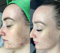 JIYU Radiant Glow Toning Pads™